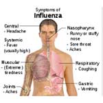 Influenza