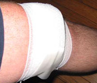 Wound